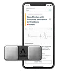 Personal EKG Device and Heart Monitor Z5230