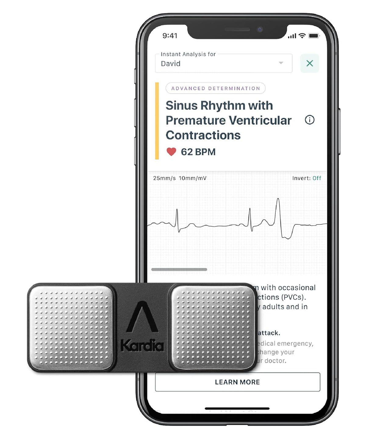 Personal EKG Device and Heart Monitor Z5230