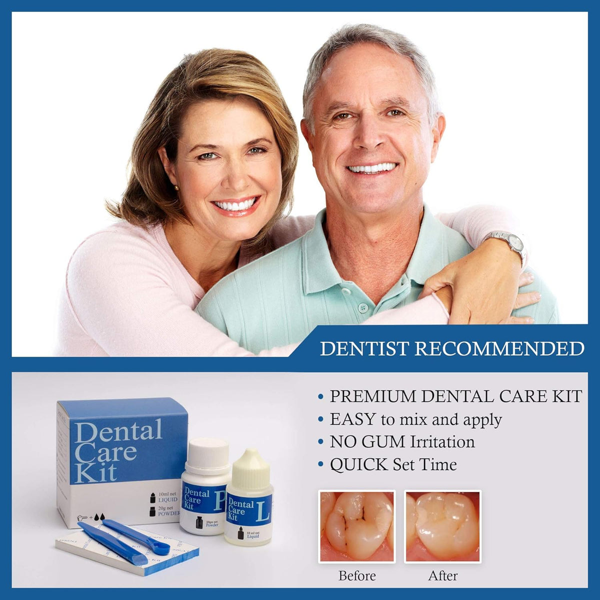 Zinc Oxide Eugenol Cement Dental Care Kit Pack of 2 P899